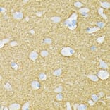 Immunohistochemistry - Anti-Munc18-1 Antibody [ARC1518] (A308829) - Antibodies.com