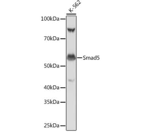 Western Blot - Anti-SMAD5 Antibody [ARC0448] (A308830) - Antibodies.com