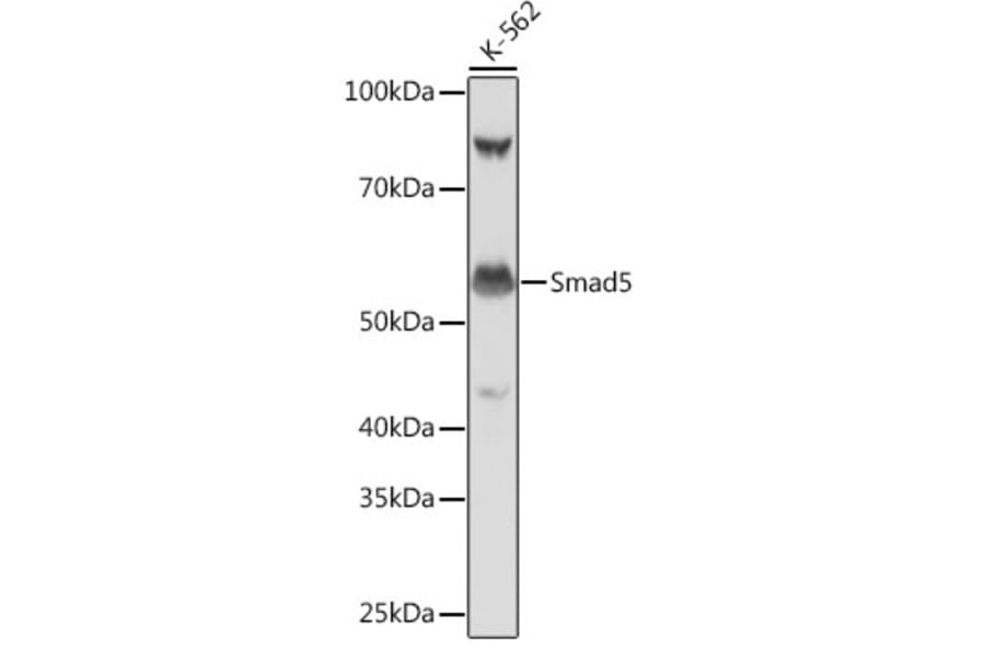 Western Blot - Anti-SMAD5 Antibody [ARC0448] (A308830) - Antibodies.com