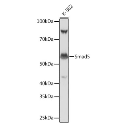 Western Blot - Anti-SMAD5 Antibody [ARC0448] (A308830) - Antibodies.com