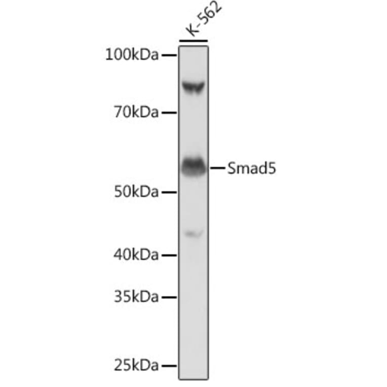 Western Blot - Anti-SMAD5 Antibody [ARC0448] (A308830) - Antibodies.com