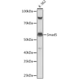 Western Blot - Anti-SMAD5 Antibody [ARC0448] (A308830) - Antibodies.com