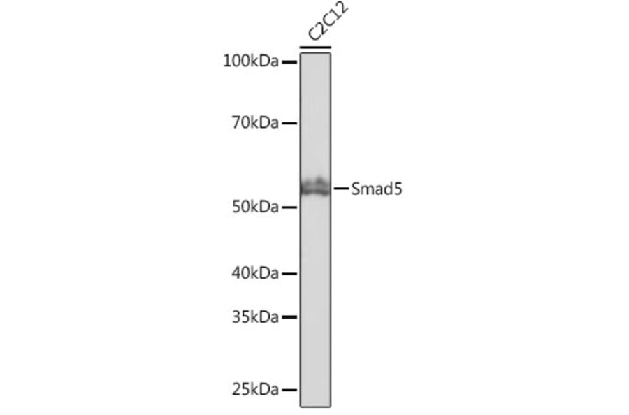 Western Blot - Anti-SMAD5 Antibody [ARC0448] (A308830) - Antibodies.com