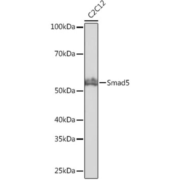 Western Blot - Anti-SMAD5 Antibody [ARC0448] (A308830) - Antibodies.com