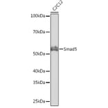 Western Blot - Anti-SMAD5 Antibody [ARC0448] (A308830) - Antibodies.com