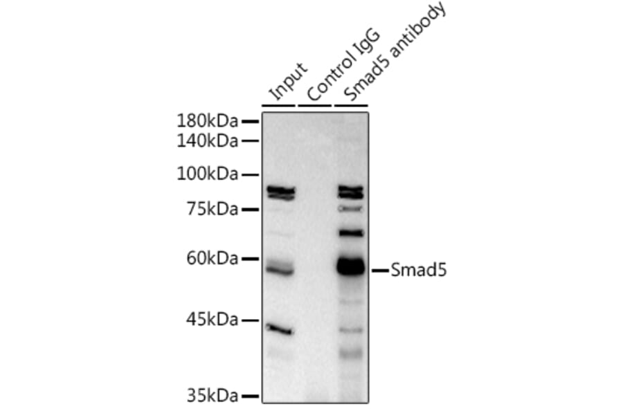 Western Blot - Anti-SMAD5 Antibody [ARC0448] (A308830) - Antibodies.com