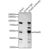 Western Blot - Anti-SMAD5 Antibody [ARC0448] (A308830) - Antibodies.com