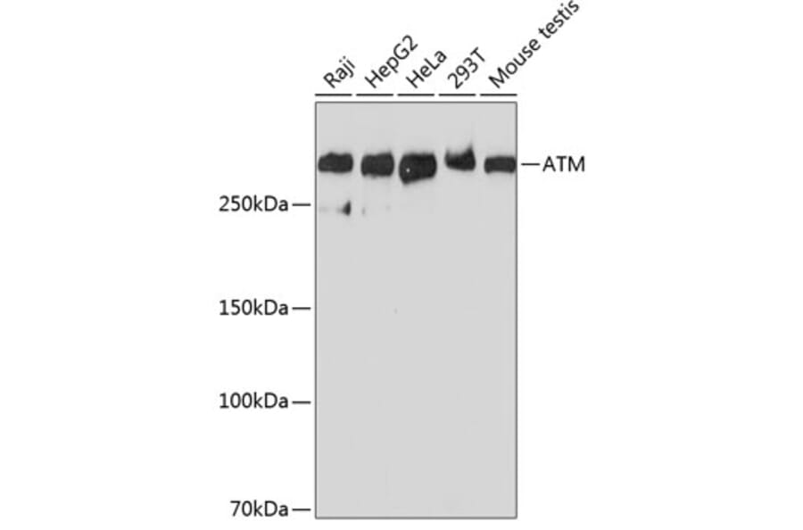 Western Blot - Anti-ATM Antibody [ARC0129] (A308831) - Antibodies.com