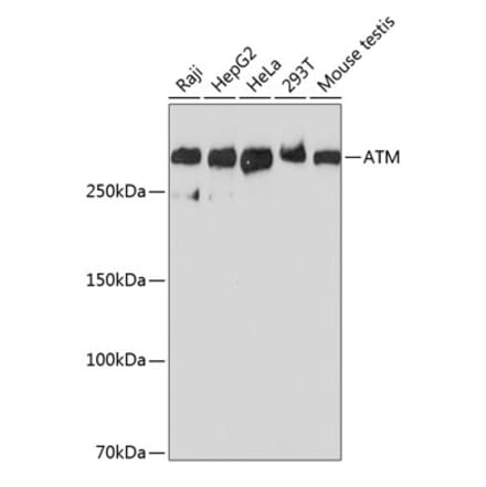 Western Blot - Anti-ATM Antibody [ARC0129] (A308831) - Antibodies.com