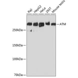 Western Blot - Anti-ATM Antibody [ARC0129] (A308831) - Antibodies.com