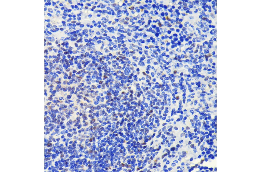 Immunohistochemistry - Anti-ATM Antibody [ARC0129] (A308831) - Antibodies.com
