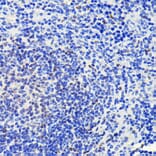 Immunohistochemistry - Anti-ATM Antibody [ARC0129] (A308831) - Antibodies.com