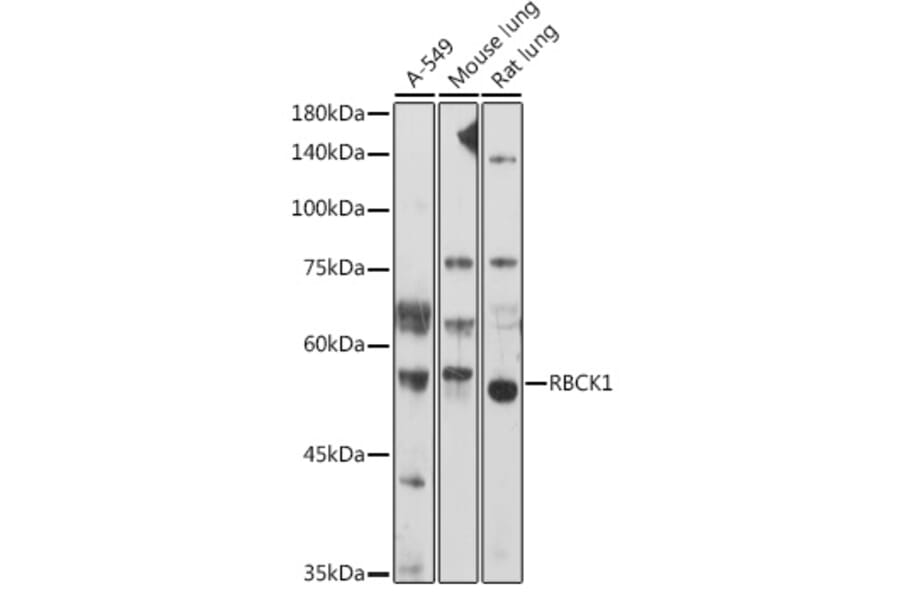 Western Blot - Anti-RBCK1 Antibody (A308832) - Antibodies.com