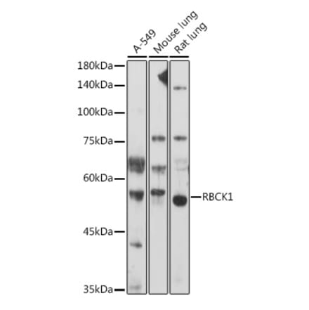 Western Blot - Anti-RBCK1 Antibody (A308832) - Antibodies.com