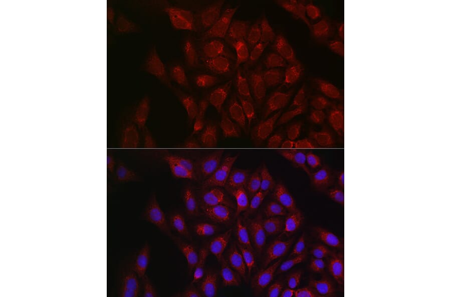 Immunofluorescence - Anti-RBCK1 Antibody (A308832) - Antibodies.com