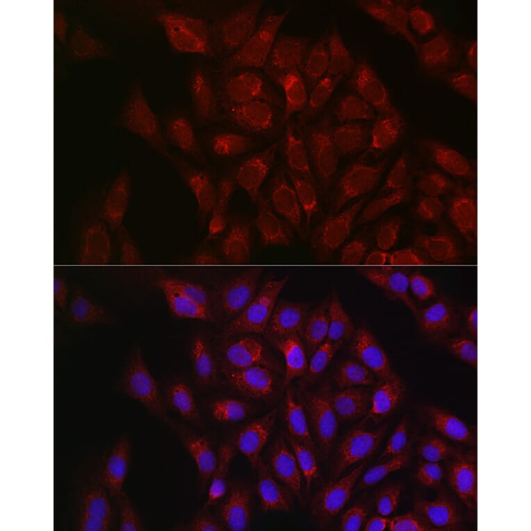 Immunofluorescence - Anti-RBCK1 Antibody (A308832) - Antibodies.com