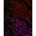 Immunofluorescence - Anti-RBCK1 Antibody (A308832) - Antibodies.com