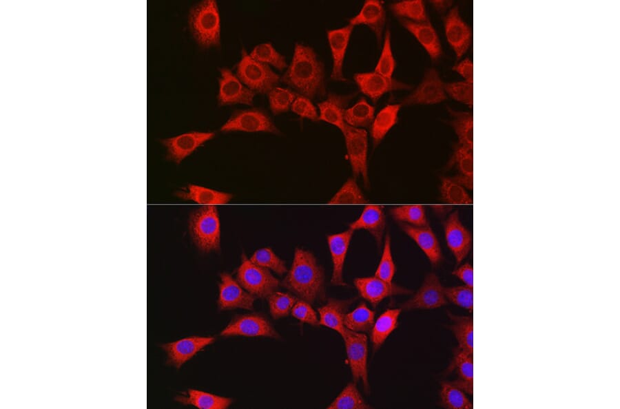 Immunofluorescence - Anti-RBCK1 Antibody (A308832) - Antibodies.com