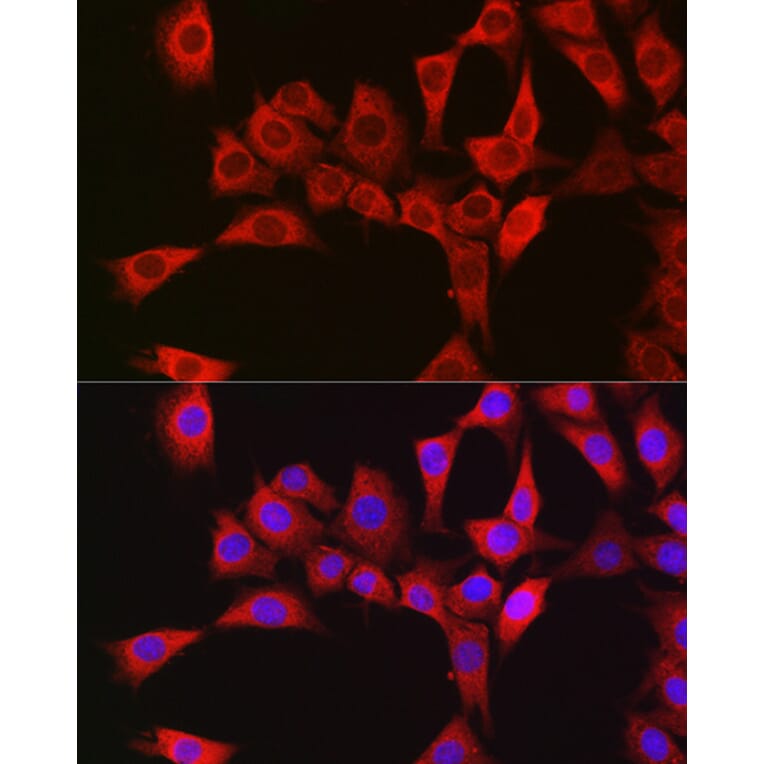Immunofluorescence - Anti-RBCK1 Antibody (A308832) - Antibodies.com