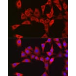 Immunofluorescence - Anti-RBCK1 Antibody (A308832) - Antibodies.com