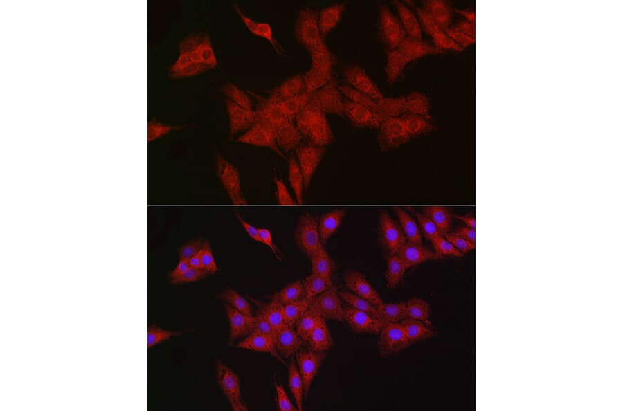 Immunofluorescence - Anti-RBCK1 Antibody (A308832) - Antibodies.com