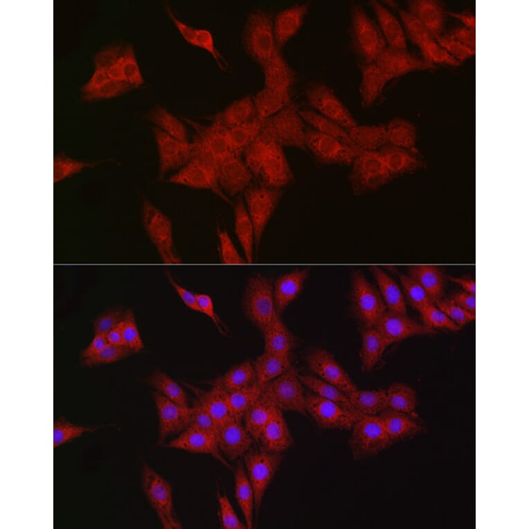Immunofluorescence - Anti-RBCK1 Antibody (A308832) - Antibodies.com