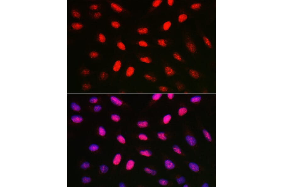 Immunofluorescence - Anti-Histone H1.1 Antibody (A308833) - Antibodies.com