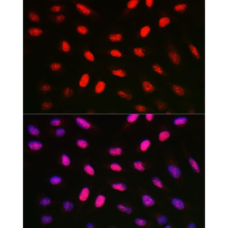 Immunofluorescence - Anti-Histone H1.1 Antibody (A308833) - Antibodies.com
