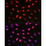 Immunofluorescence - Anti-Histone H1.1 Antibody (A308833) - Antibodies.com