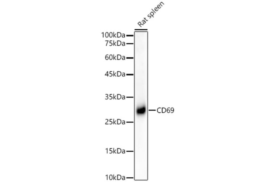 Western Blot - Anti-CD69 Antibody [ARC56158] (A308834) - Antibodies.com