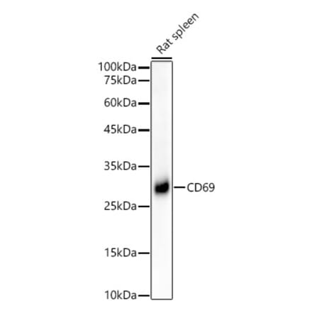 Western Blot - Anti-CD69 Antibody [ARC56158] (A308834) - Antibodies.com