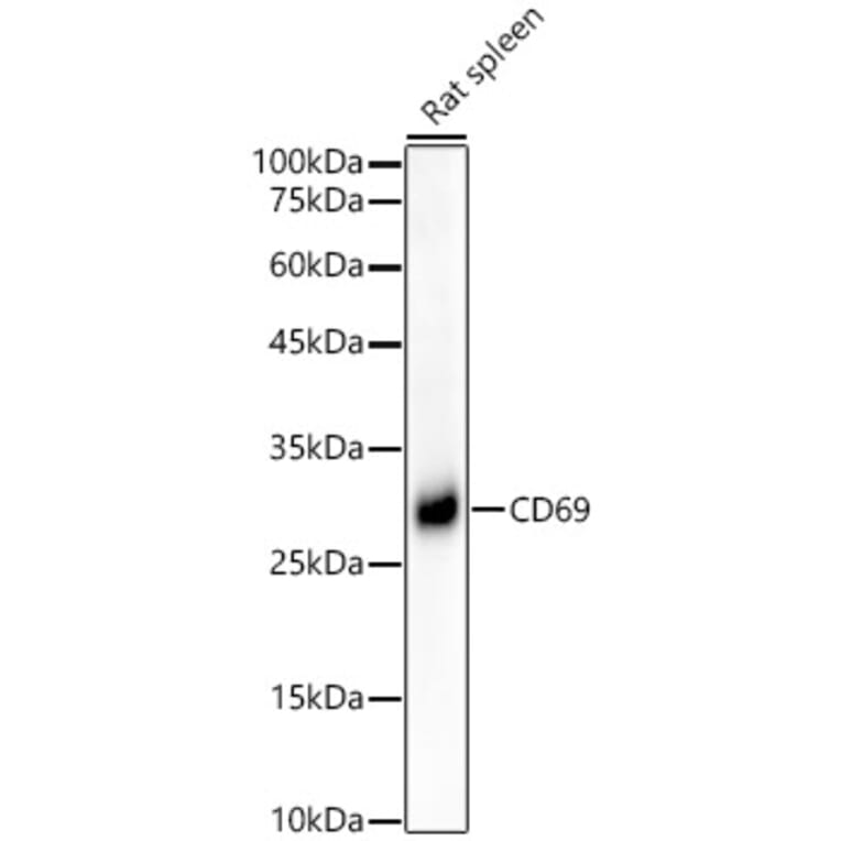 Western Blot - Anti-CD69 Antibody [ARC56158] (A308834) - Antibodies.com