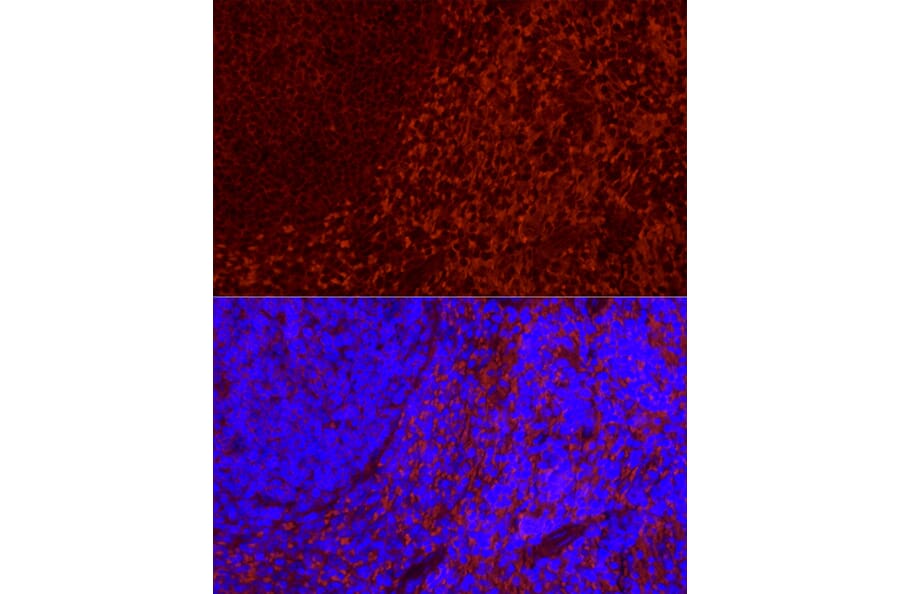 Immunofluorescence - Anti-CD69 Antibody [ARC56158] (A308834) - Antibodies.com