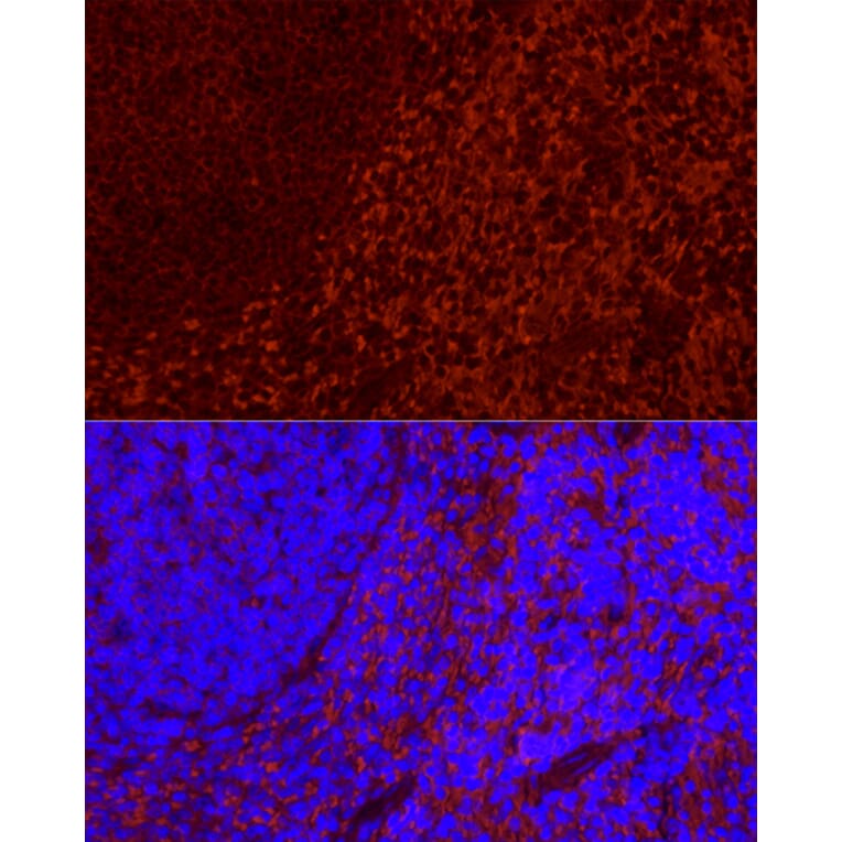 Immunofluorescence - Anti-CD69 Antibody [ARC56158] (A308834) - Antibodies.com
