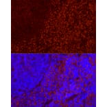 Immunofluorescence - Anti-CD69 Antibody [ARC56158] (A308834) - Antibodies.com