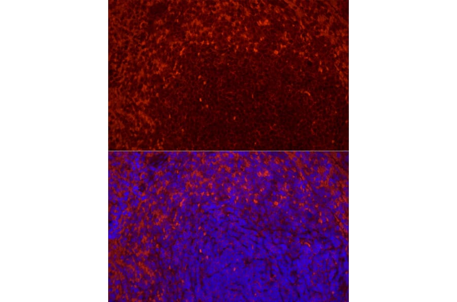 Immunofluorescence - Anti-CD69 Antibody [ARC56158] (A308834) - Antibodies.com