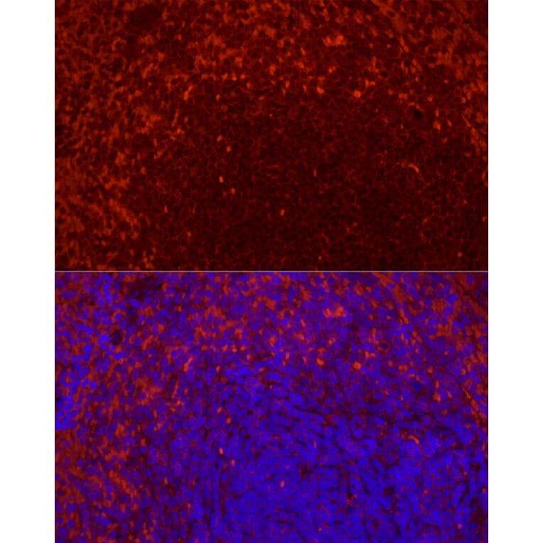 Immunofluorescence - Anti-CD69 Antibody [ARC56158] (A308834) - Antibodies.com