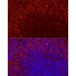 Immunofluorescence - Anti-CD69 Antibody [ARC56158] (A308834) - Antibodies.com