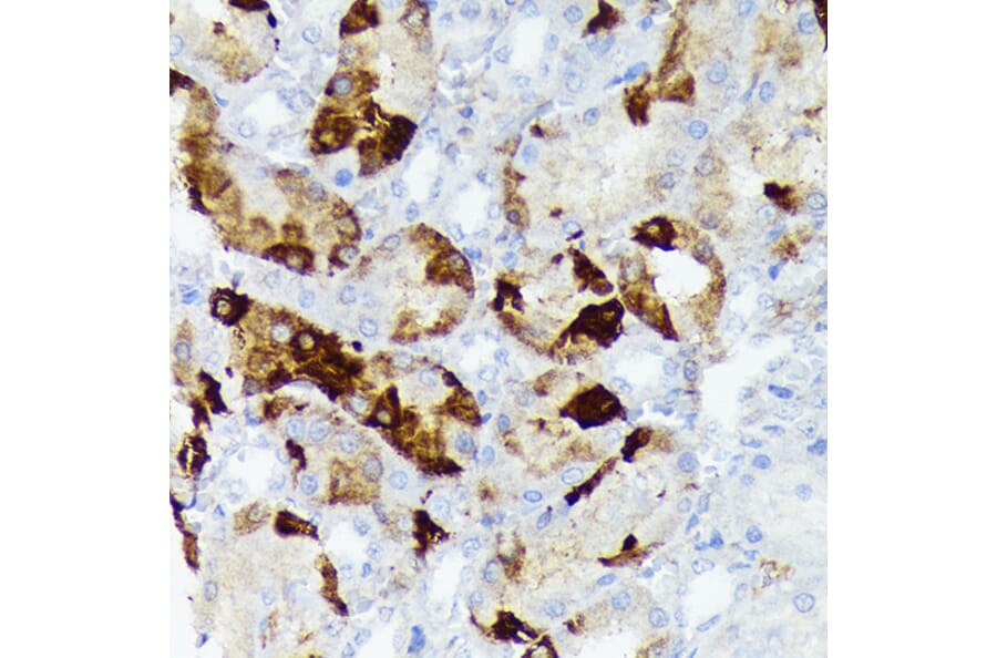 Immunohistochemistry - Anti-Alpha B Crystallin Antibody [ARC1672] (A308835) - Antibodies.com
