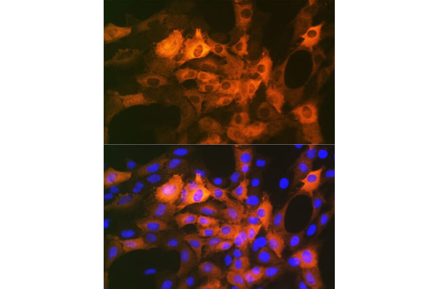 Immunofluorescence - Anti-Alpha B Crystallin Antibody [ARC1672] (A308835) - Antibodies.com