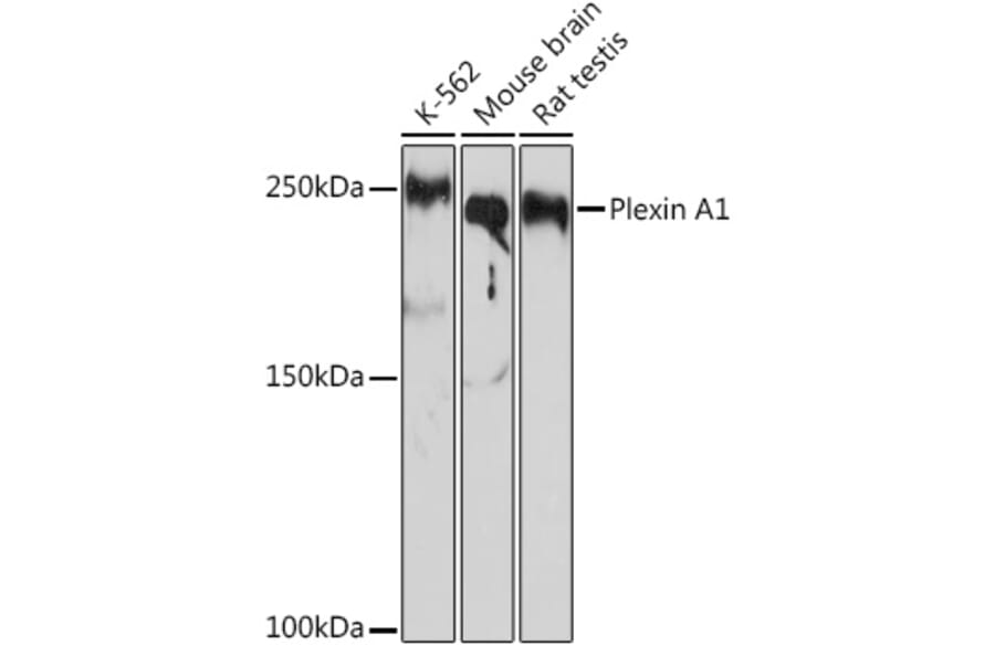 Western Blot - Anti-Plexin A1 Antibody [ARC2077] (A308836) - Antibodies.com