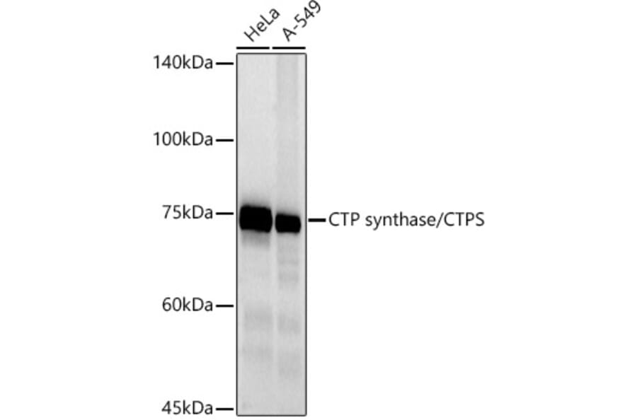 Western Blot - Anti-CTP synthase/CTPS Antibody [ARC2883] (A308837) - Antibodies.com