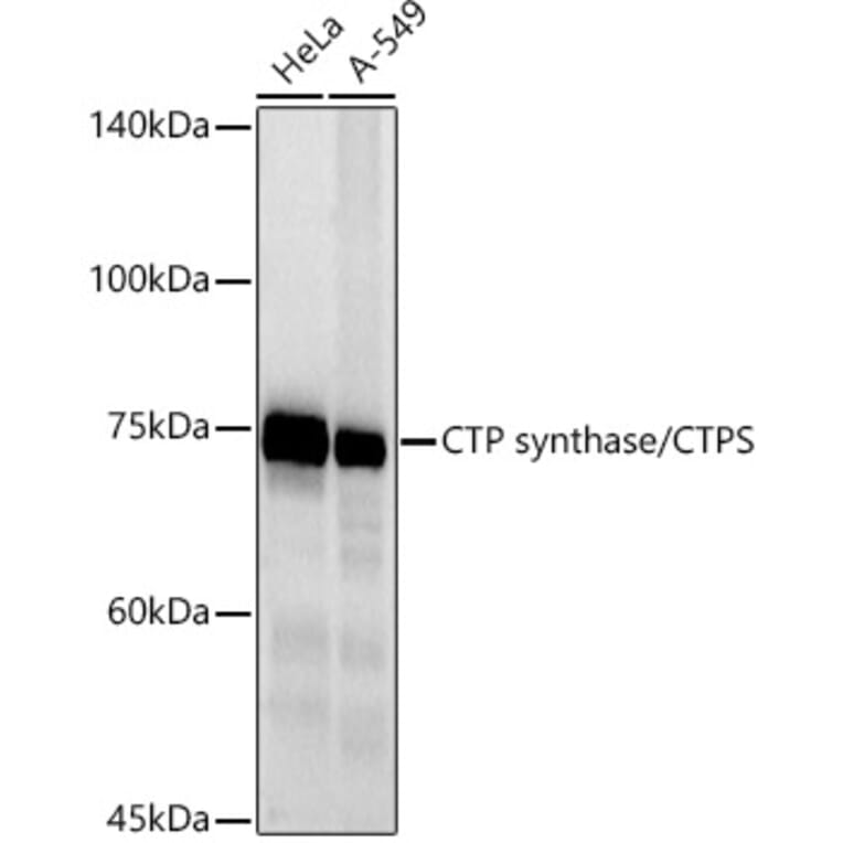 Western Blot - Anti-CTP synthase/CTPS Antibody [ARC2883] (A308837) - Antibodies.com