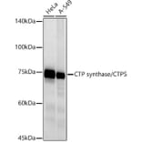 Western Blot - Anti-CTP synthase/CTPS Antibody [ARC2883] (A308837) - Antibodies.com