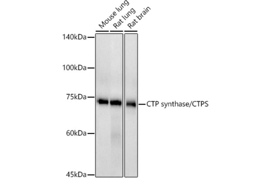 Western Blot - Anti-CTP synthase/CTPS Antibody [ARC2883] (A308837) - Antibodies.com