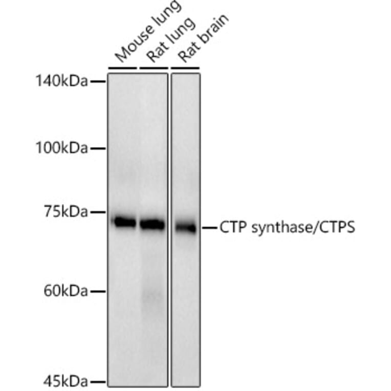 Western Blot - Anti-CTP synthase/CTPS Antibody [ARC2883] (A308837) - Antibodies.com
