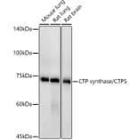 Western Blot - Anti-CTP synthase/CTPS Antibody [ARC2883] (A308837) - Antibodies.com