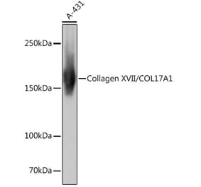 Western Blot - Anti-Collagen XVII Antibody [ARC0233] (A308839) - Antibodies.com
