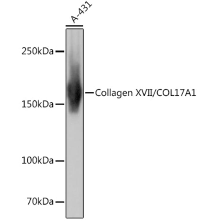 Western Blot - Anti-Collagen XVII Antibody [ARC0233] (A308839) - Antibodies.com