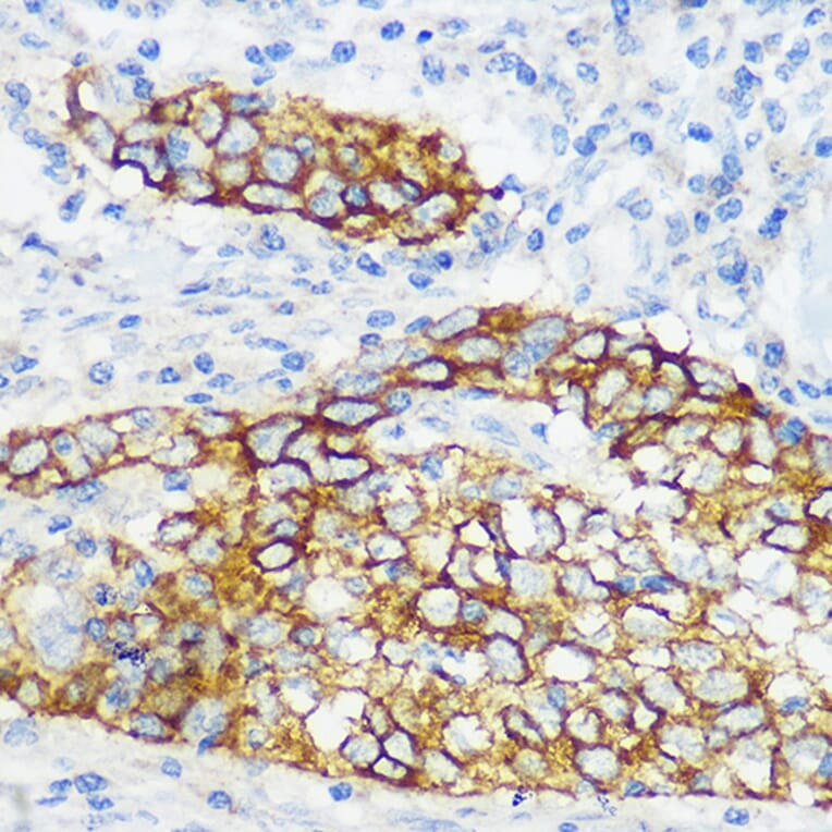 Immunohistochemistry - Anti-Collagen XVII Antibody [ARC0233] (A308839) - Antibodies.com